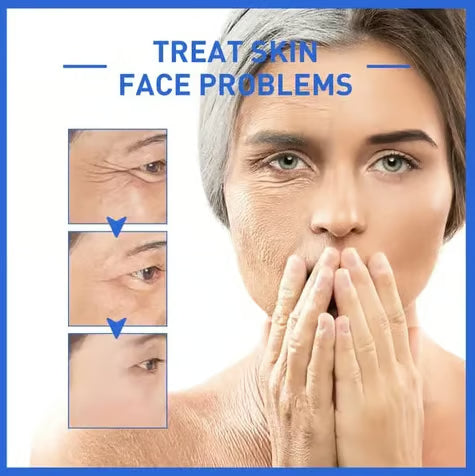DermaClarity Elixir - Erase Post-Acne Marks - 50% OFF