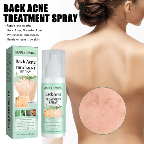 Back Acne Spray Fast-Acting Body Blemish Treatment for Women - Clear Skin Without the Harshness - 1+1 FREE