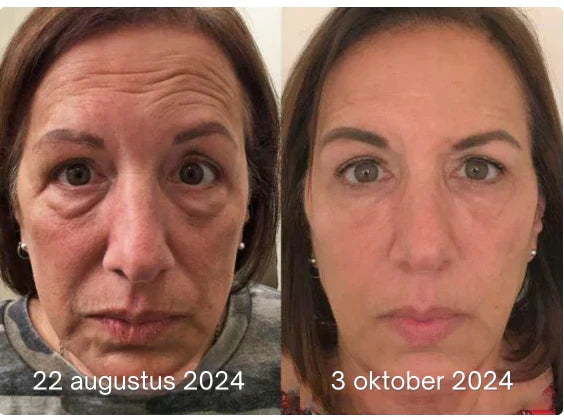 LumiVive – Reclaim Youthful Radiance - 50% OFF