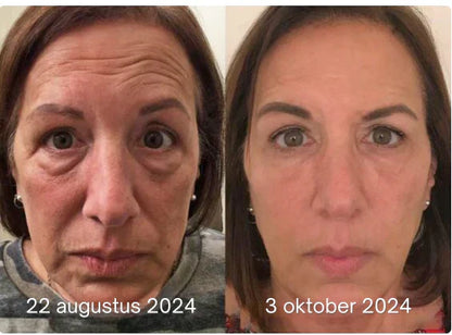 LumiVive – Reclaim Youthful Radiance - 50% OFF