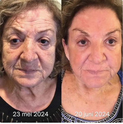 LumiVive – Reclaim Youthful Radiance - 50% OFF