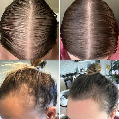 The EELHOE Natural Growth Oil - Rosemary, Castor, and Green Coffee for Thicker, Fuller Hair +  50% OFF