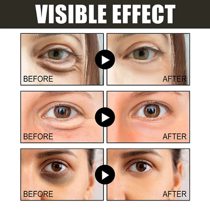 The EyeAwake Cream - The End of Tired-Looking Eyes - 50% OFF