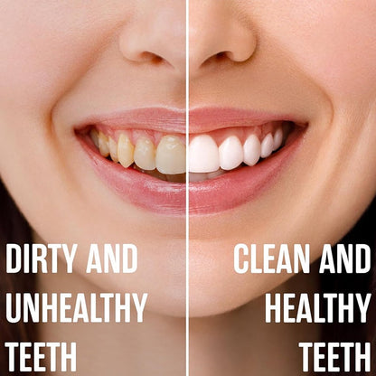 Revitrin - Rebuild Your Enamel, Restore Your Smile - 50% OFF