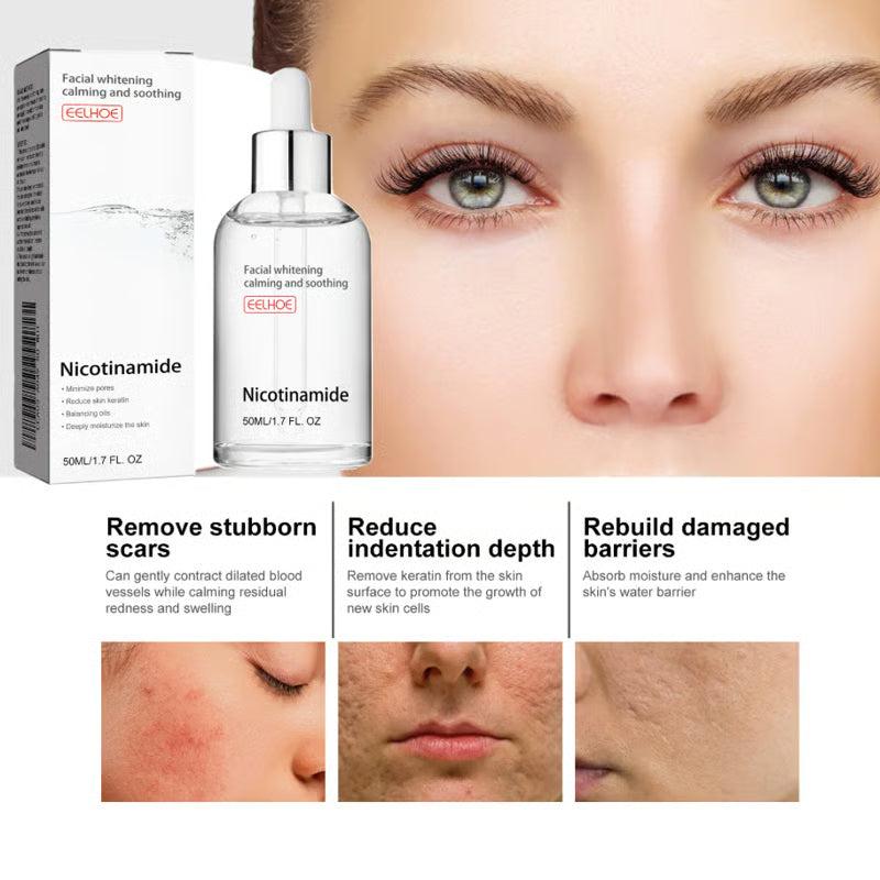 DermaClarity Elixir - Erase Post-Acne Marks - 50% OFF