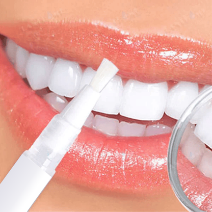 The SmileFitPro Pen - Whiter Smile in 7 Days, Zero Sensitivity +50% OFF