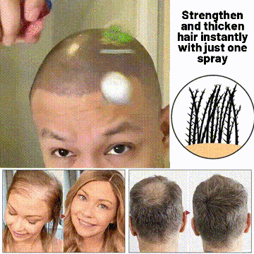 Lovilds Natural Hair Regrowth Spray - Clinically-Inspired Scalp Treatment - 1+1 FREE