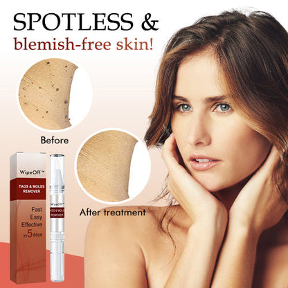 1 + 1 Free - WipeOff™ Marker & Mole Remover