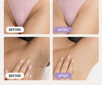 CloudSense – Pain-Free Bikini Hair Removal Cream & Spray Kit + 1+1 FREE features