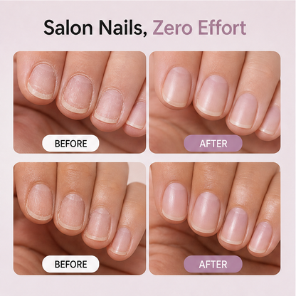 Cuticelle – Precision Cuticle Oil Pen for Soft, Salon-Look Nails + 1+1 FREE features