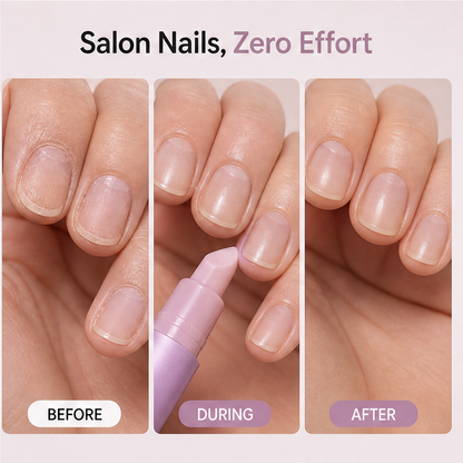 Cuticelle – Precision Cuticle Oil Pen for Soft, Salon-Look Nails + 1+1 FREE features