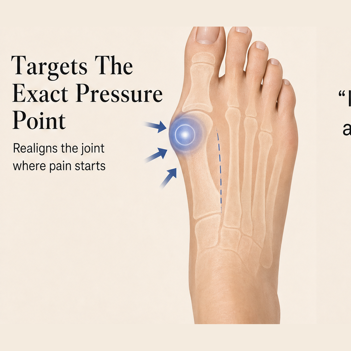 Flexara – EMS Microcurrent Bunion Splint for All-Day Toe Pain Relief + 50% OFF detail