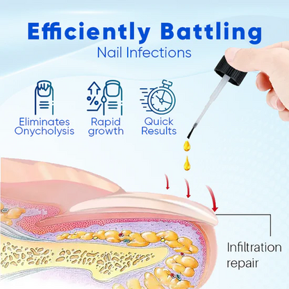 OnyxoGuard Serum - Stronger Nails in 2 Weeks + 50% OFF