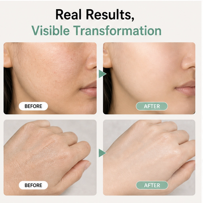 Aloria™ – Herbal Brightening Peeling Gel with Aloe Vera, 50g + 1+1 FREE