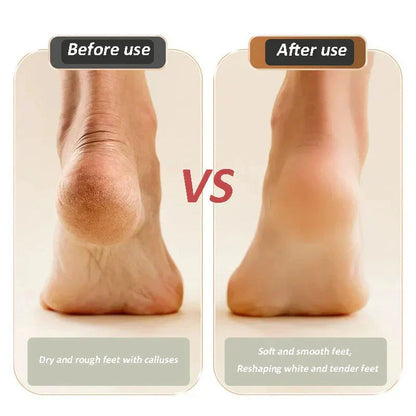 SoleSmooth Pro - Get Pedicure-Perfect Feet in Minutes - 50% OFF