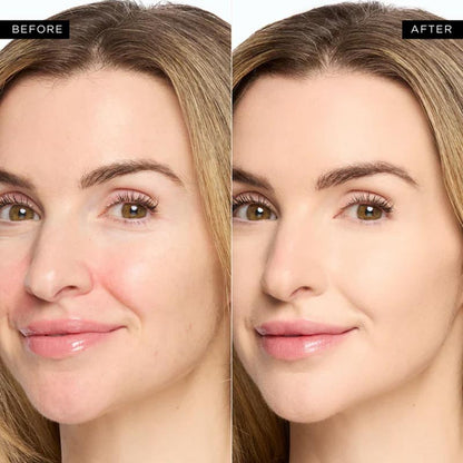 ChromaCorrect Elixir + Banish Shadows, Unveil Luminous, Flawless Under-Eyes - 50% OFF