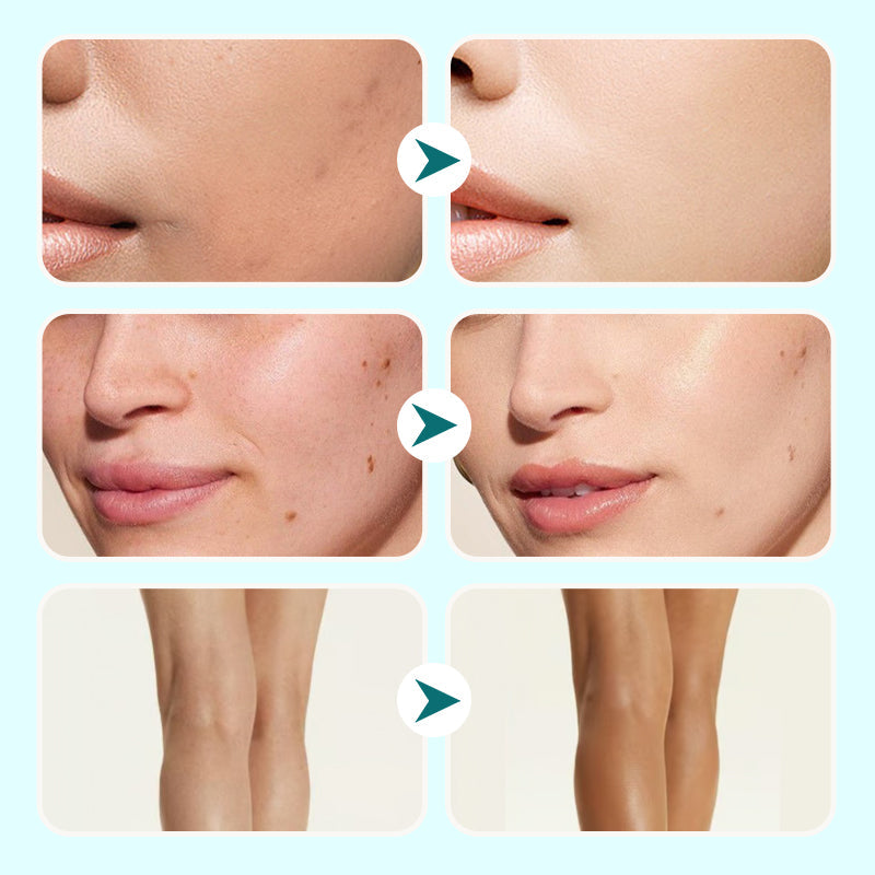 LuminousBlend All-in-One Moisture Concealer - 1+1 FREE